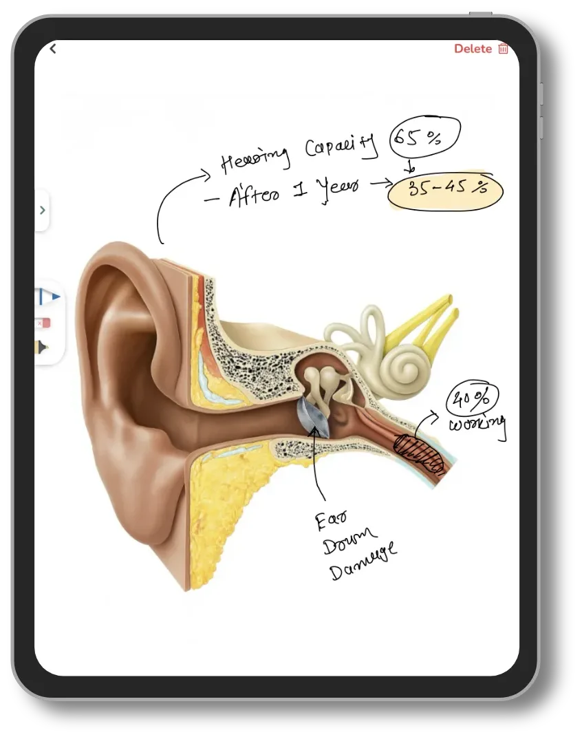 Doctor's notes drawn on an ENT anatomy diagram in Lifemaan on a tablet