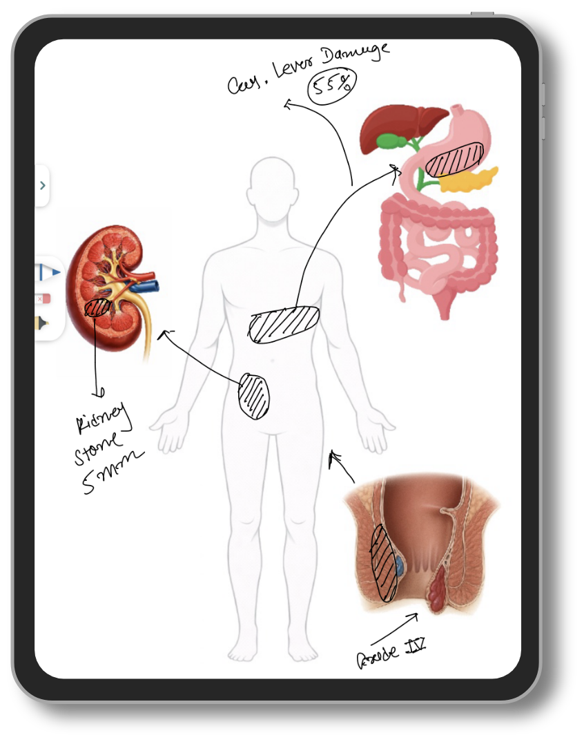 Patient education on Lifemaan tablet