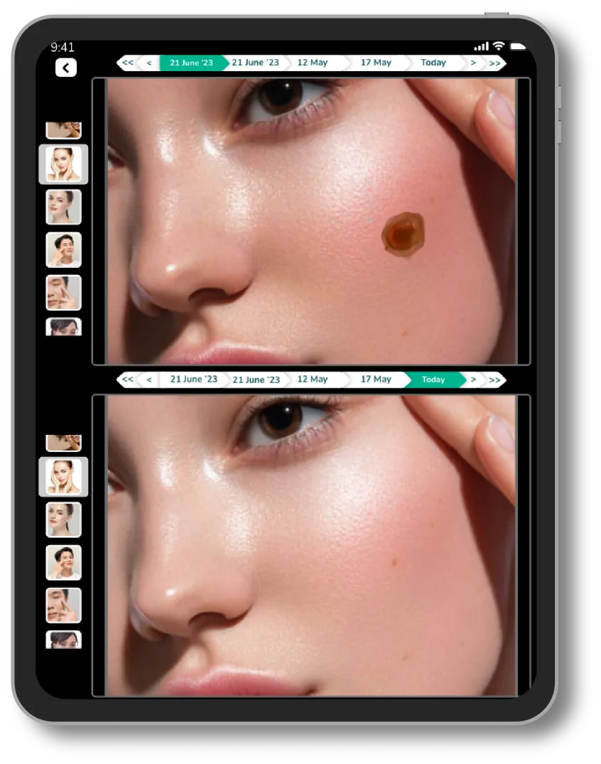 Lifemaan photo comparison: a facial skin lesion photographed at two visits, shown one above the other with the visit dates