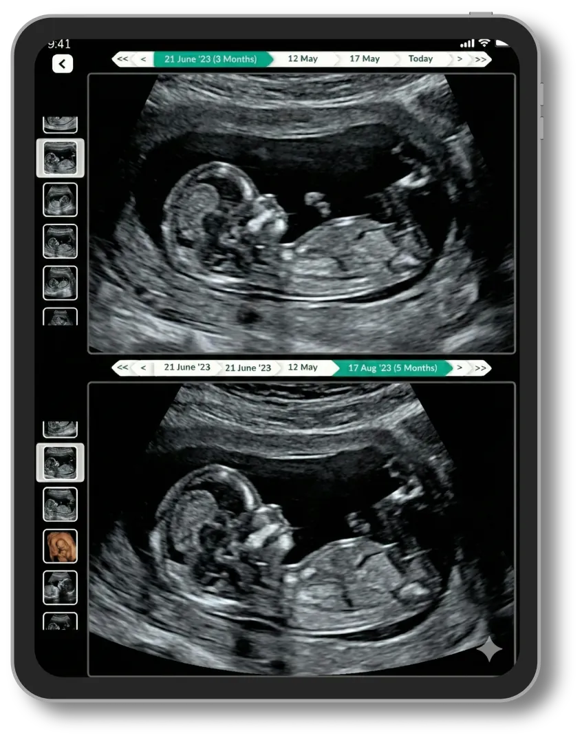 Lifemaan image comparison: fetal ultrasound images from two visits shown one above the other