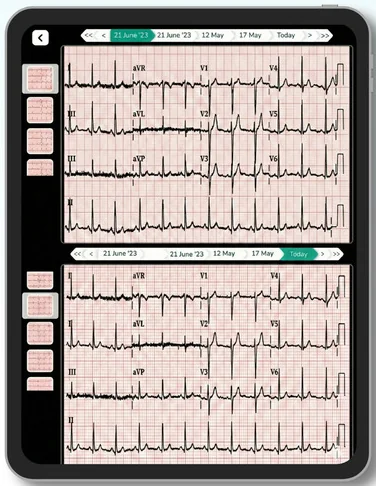 Lifemaan image comparison: ECGs from two visits shown one above the other
